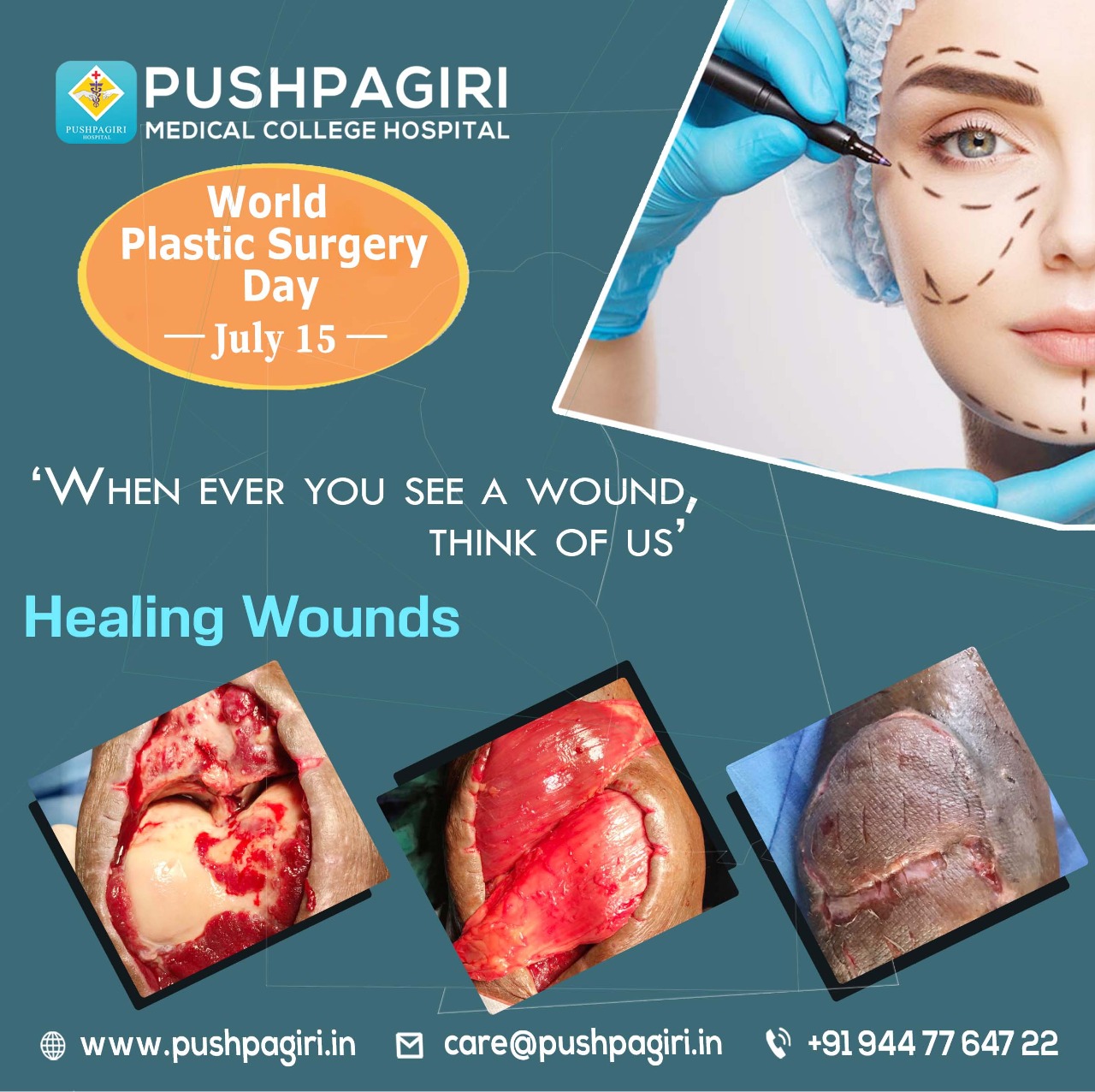 Pushpagiri Plastic Surgery Dept.
