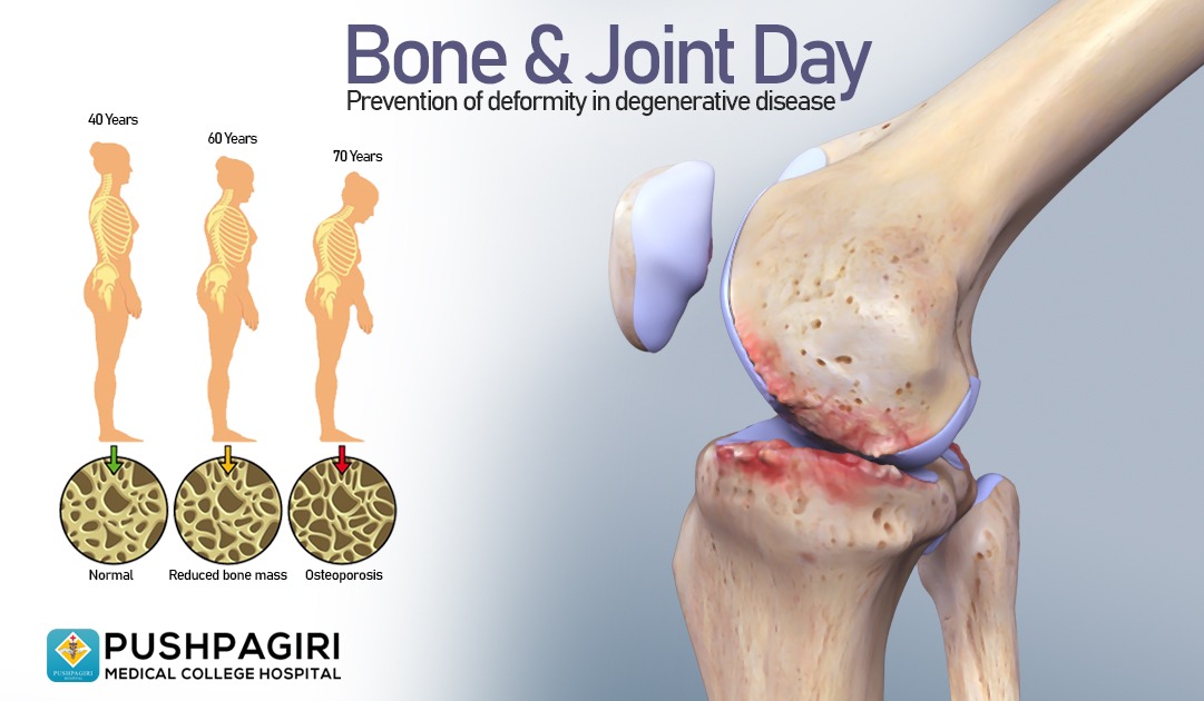 Pushpagiri Department of Orthopedics - Bone Joint Day - 4th August